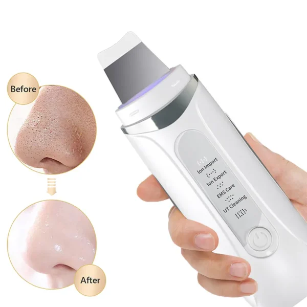 Ultrasonic Facial Pore Cleaner Machine